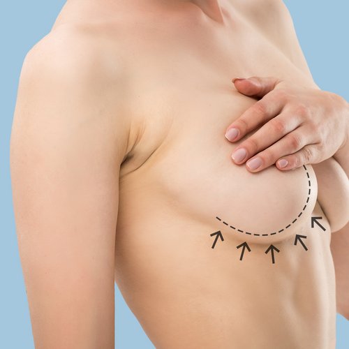 https://idoweb.me/images/services/Breast-Lift.jpg