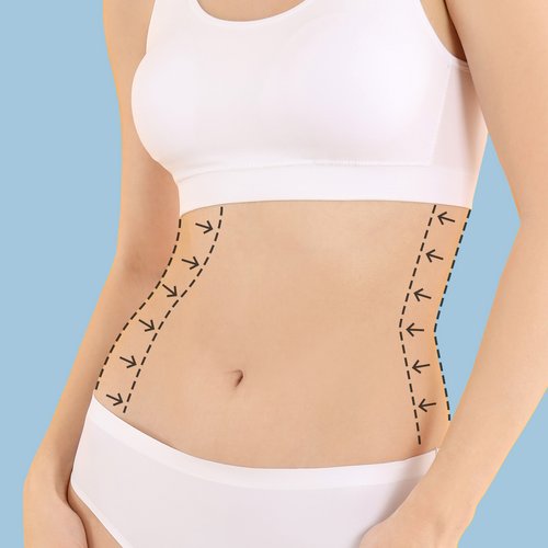 https://idoweb.me/images/services/after-weightloss-body-contouring.jpg