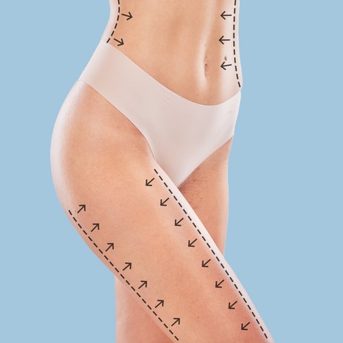 https://idoweb.me/images/services/body-liposuction.jpg