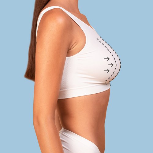 https://idoweb.me/images/services/breast-augmentation.jpg
